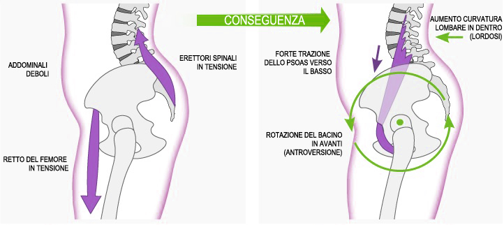 TENSIONE COLONNA VERTEBRALE SCARICA